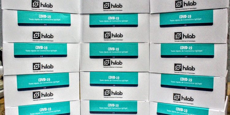 Butantan enviou mais 5 mil testes rápidos para Bragança
