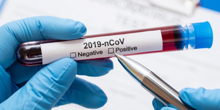 Pesquisa divulga resultados de prevalência da Covid-19 em bragantinos