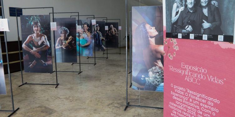 Mostra da ABCC sobre câncer de mama ficará na Câmara até o dia 29   